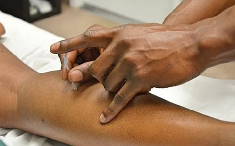 針灸科出科自我鑒定(精選13篇)